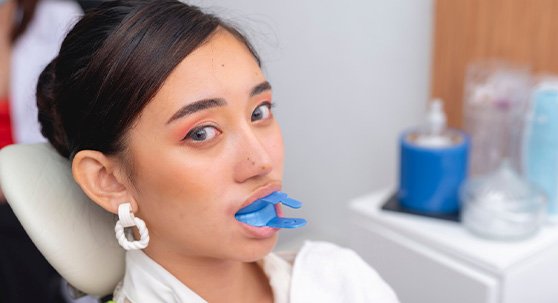 Woman with blue fluoride trays over teeth