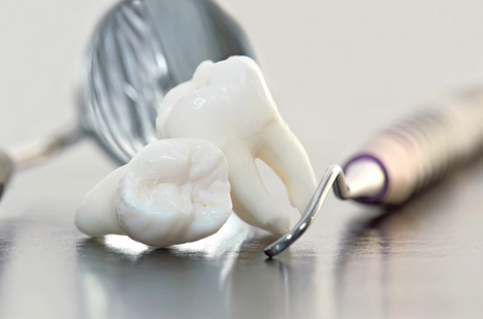 Two teeth next to dental tools