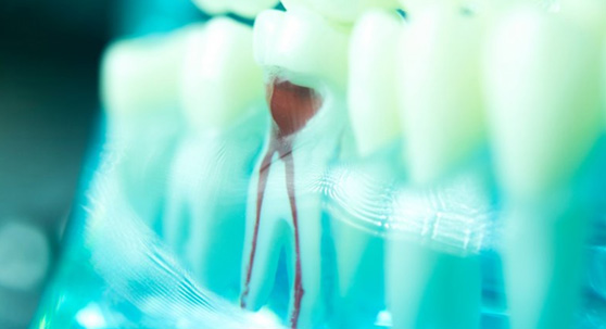 A clear display that shows a tooth’s dental roots