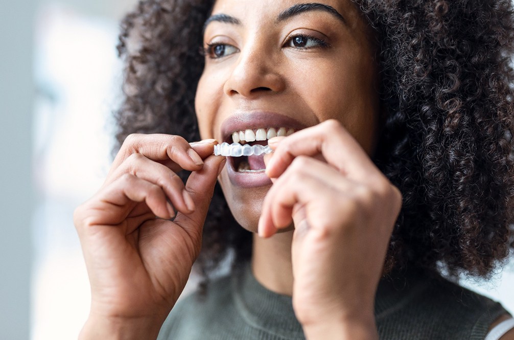Young female inserting Invisalign in Lakewood