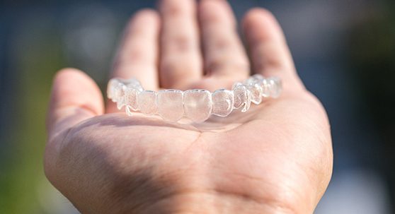 Invisalign aligner in a person’s hand